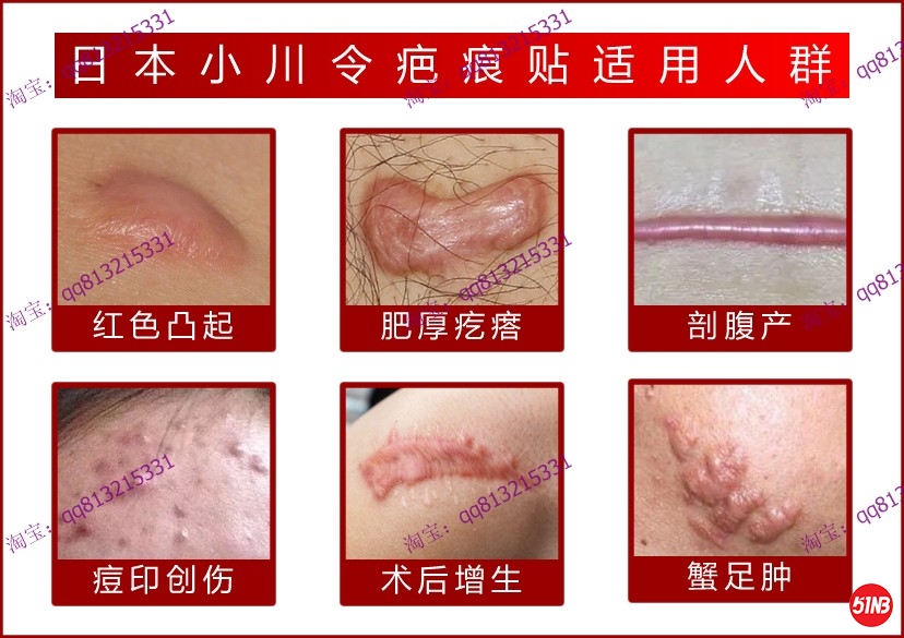 适用人群.jpg